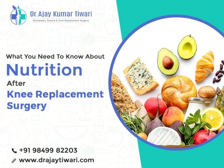 What you need to know about nutrition after Knee Replacement Surgery